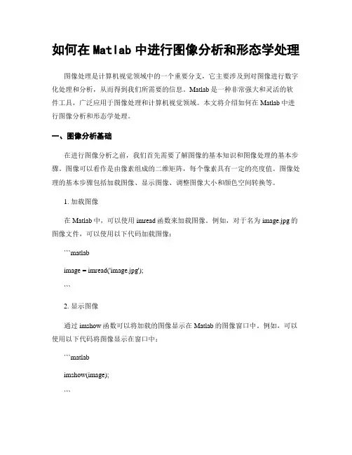 如何在Matlab中进行图像分析和形态学处理