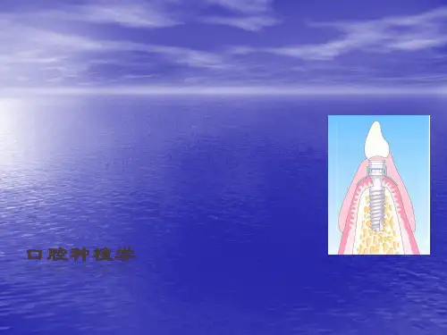 口腔种植术PPT课件