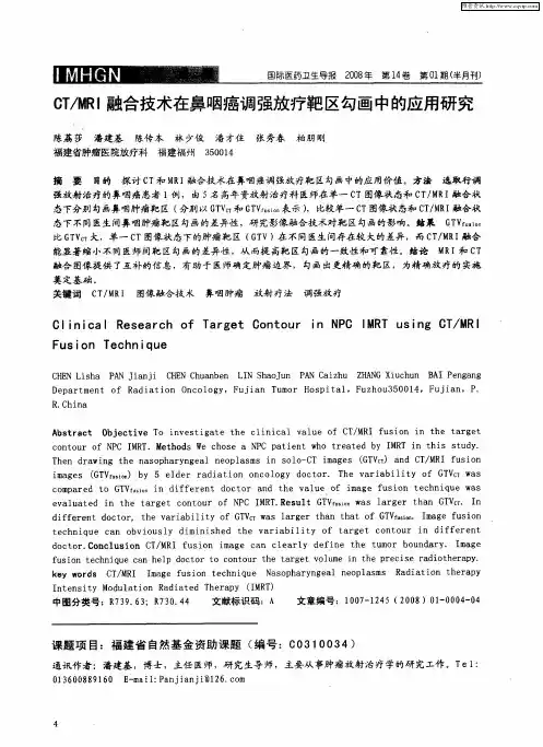 CT／MRI融合技术在鼻咽癌调强放疗靶区勾画中的应用研究