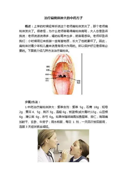 治疗扁桃体肿大的中药方子
