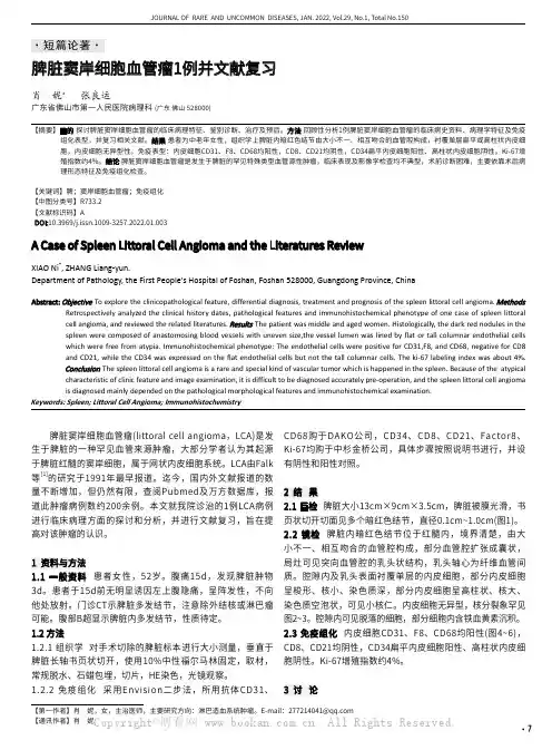 脾脏窦岸细胞血管瘤1例并文献复习
