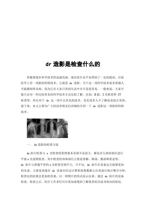 dr造影是检查什么的