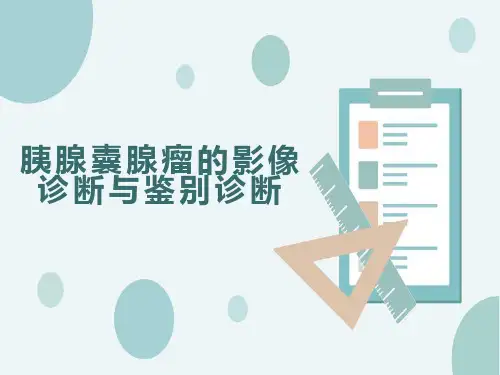 胰腺囊腺瘤的影像诊断与鉴别诊断