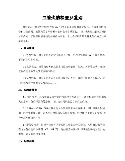 血管炎的检查及鉴别