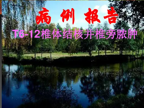 胸椎结核