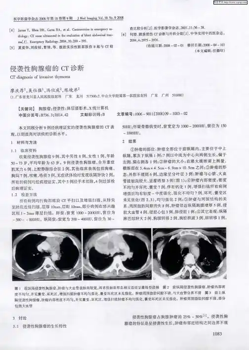 侵袭性胸腺瘤的CT诊断