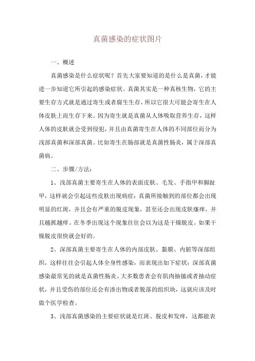 真菌感染的症状图片