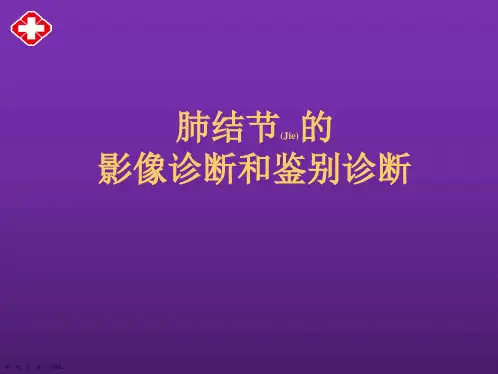肺结节的影像诊断及治疗完整版ppt可修改文字