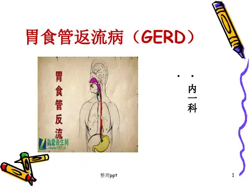 胃食管反流病