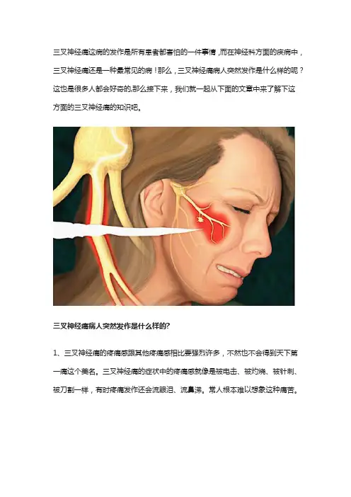 三叉神经痛病人突然发作是什么样的？为何令人痛苦不堪？