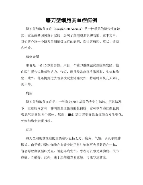 镰刀型细胞贫血症病例