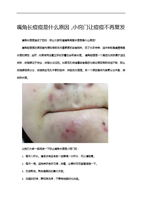 嘴角长痘痘是什么原因,小窍门让痘痘不再复发