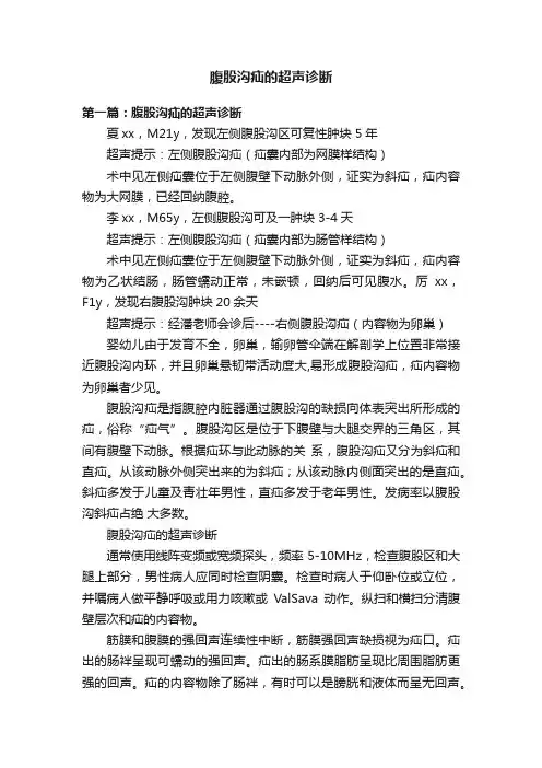 腹股沟疝的超声诊断