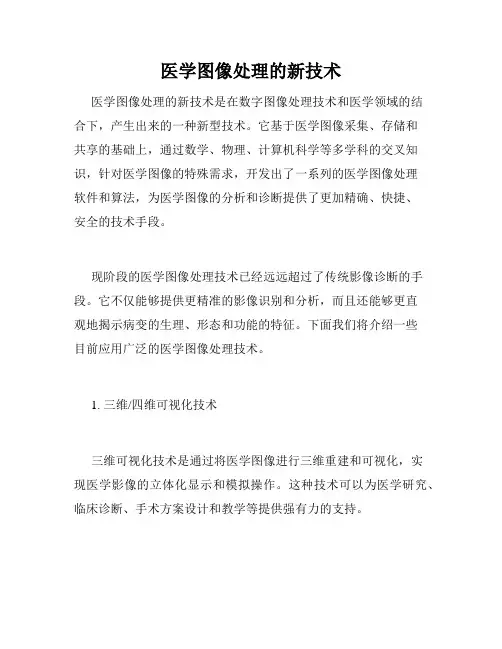 医学图像处理的新技术
