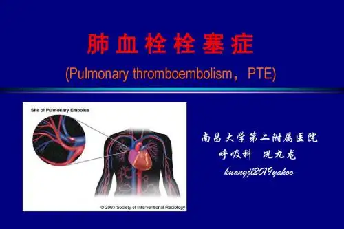 内科学肺栓塞教案-PPT课件