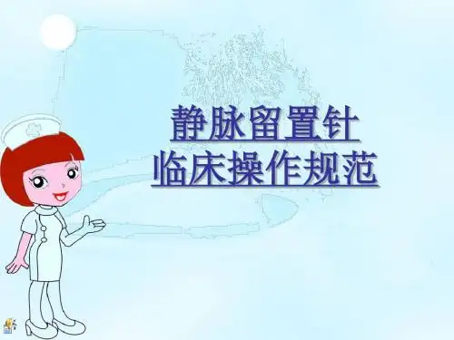 静脉留置针临床操作规范