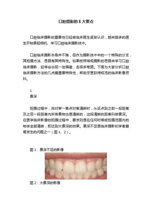 口腔摄影的5大要点