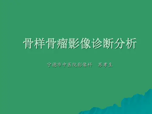 骨样骨瘤