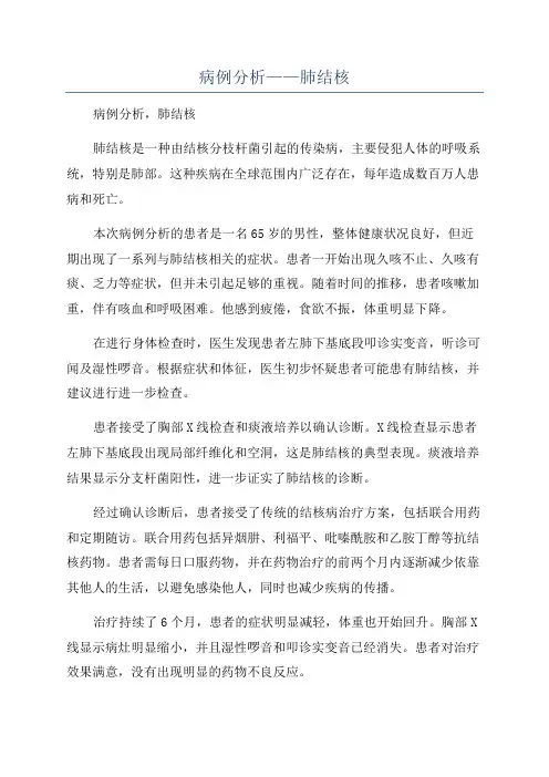 病例分析——肺结核