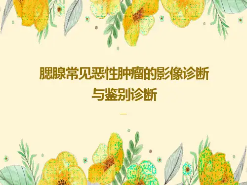 腮腺常见恶性肿瘤的影像诊断与鉴别诊断