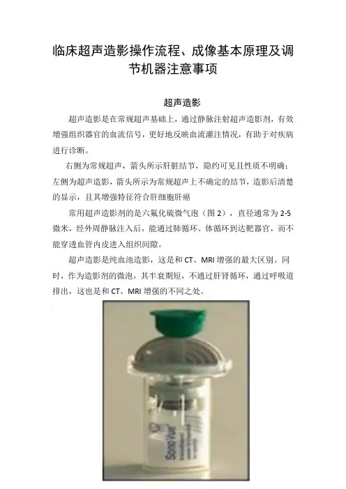 临床超声造影操作流程、成像基本原理及调节机器注意事项