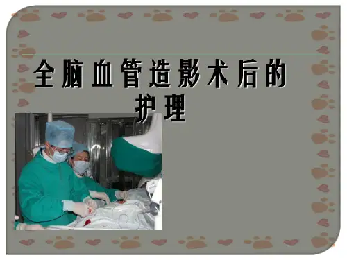全脑血管造影术后的护理