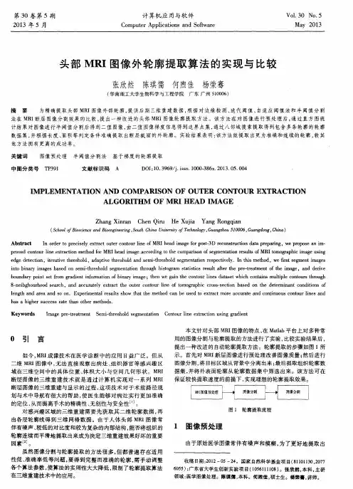 头部MRI图像外轮廓提取算法的实现与比较
