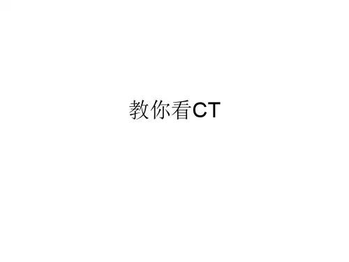 头部CT-PPT课件