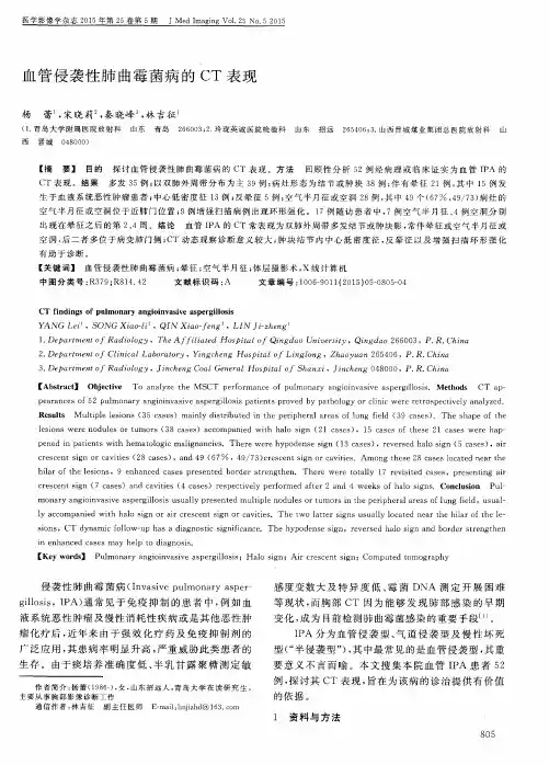 血管侵袭性肺曲霉菌病的 CT 表现
