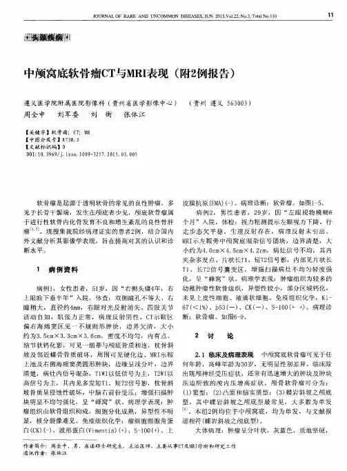 中颅窝底软骨瘤CT与MRI表现(附2例报告)