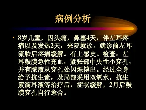 医学专题急性中耳炎的应急处理方法