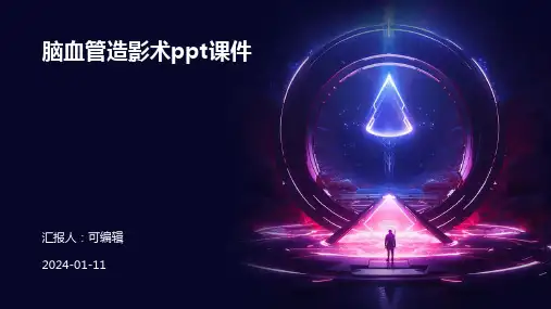 脑血管造影术ppt课件