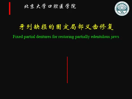 Fixed bridge-1文字版课件共109页