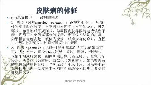 皮肤病的症状体征与诊断