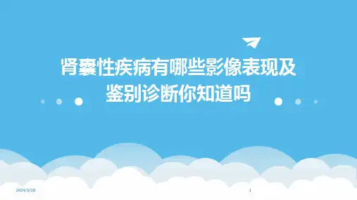 肾囊性疾病有哪些影像表现及鉴别诊断你知道吗-2024鲜版