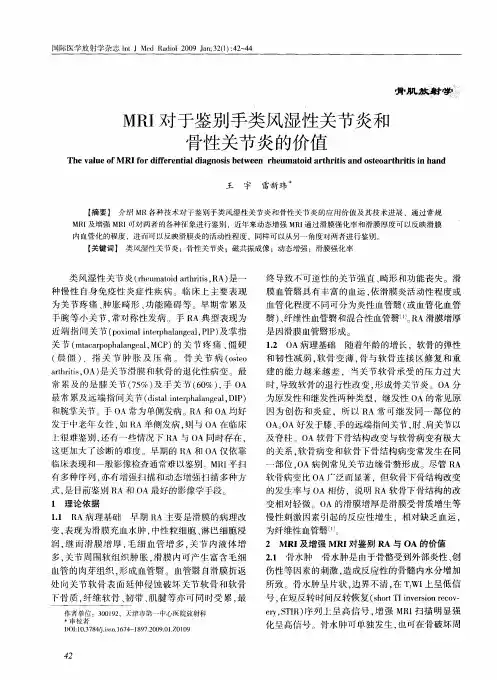 MRI对于鉴别手类风湿性关节炎和骨性关节炎的价值