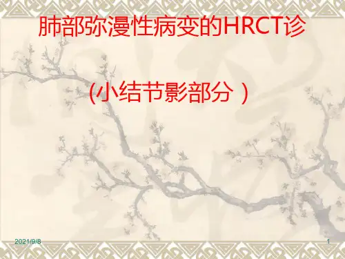 肺部弥漫性病变的HRCT鉴别诊断