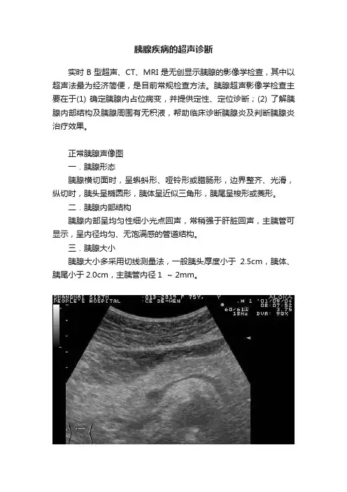 胰腺疾病的超声诊断