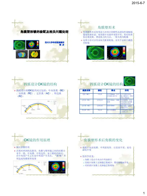 角膜塑形镜验配及相关问题处理