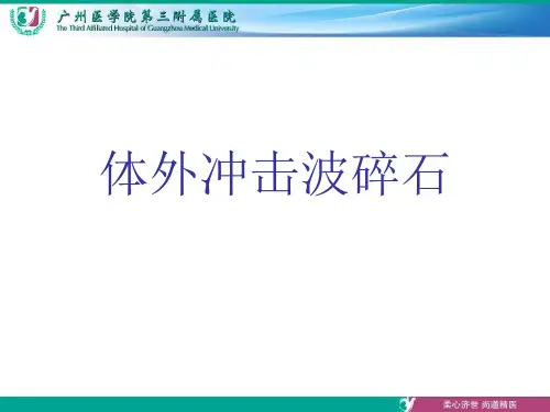 体外冲击波碎石