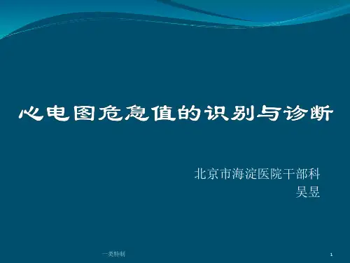 心电图危急值[行业知识]