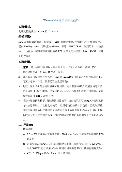 Western blot操作步骤及技巧