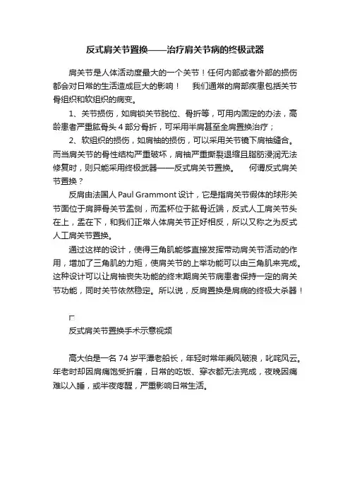 反式肩关节置换——治疗肩关节病的终极武器