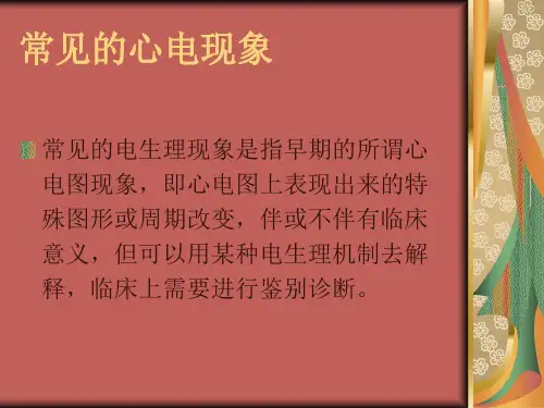 常见的心电现象