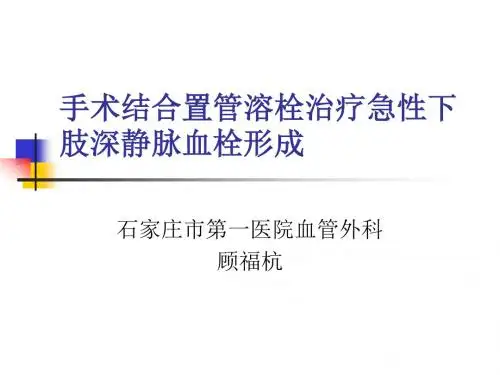 手术结合置管溶栓治疗急性下肢深静脉血栓形成详解