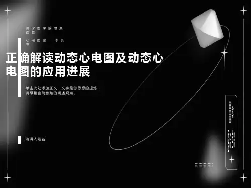 正确解读动态心电图