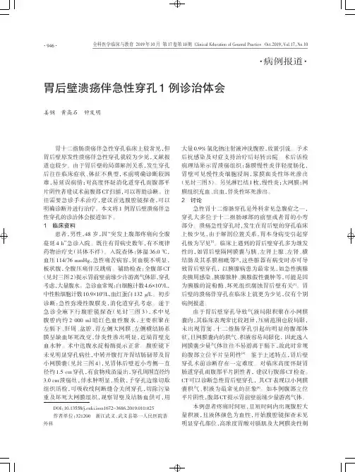 胃后壁溃疡伴急性穿孔1例诊治体会