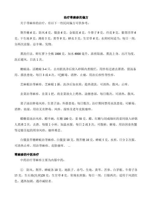 治疗荨麻疹的偏方