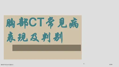 胸部CT常见病专题知识