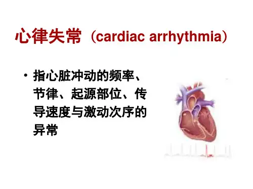 心律失常课件【PPT】